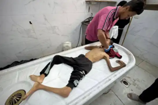 لە غەززە ١٠ کەسی دیکە بەهۆی برسێتی گیانیان لەدەستدا
