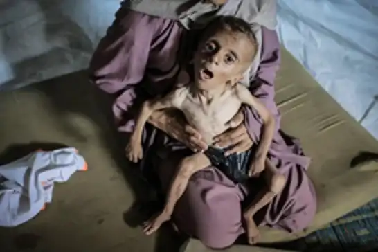 منظمة "أنقذوا الأطفال": أطفال غزة باتوا عاجزين عن الصراخ من شدة الجوع