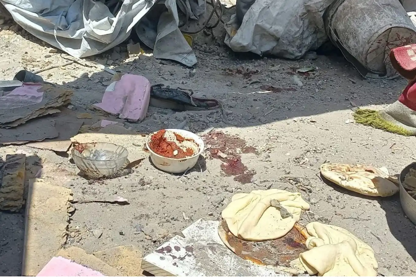 Siyonistin açlık silahı, Gazze'de bir çocuğu daha hayattan koparttı! Siyonistin açlık silahı, Gazze'de bir çocuğu daha hayattan koparttı!