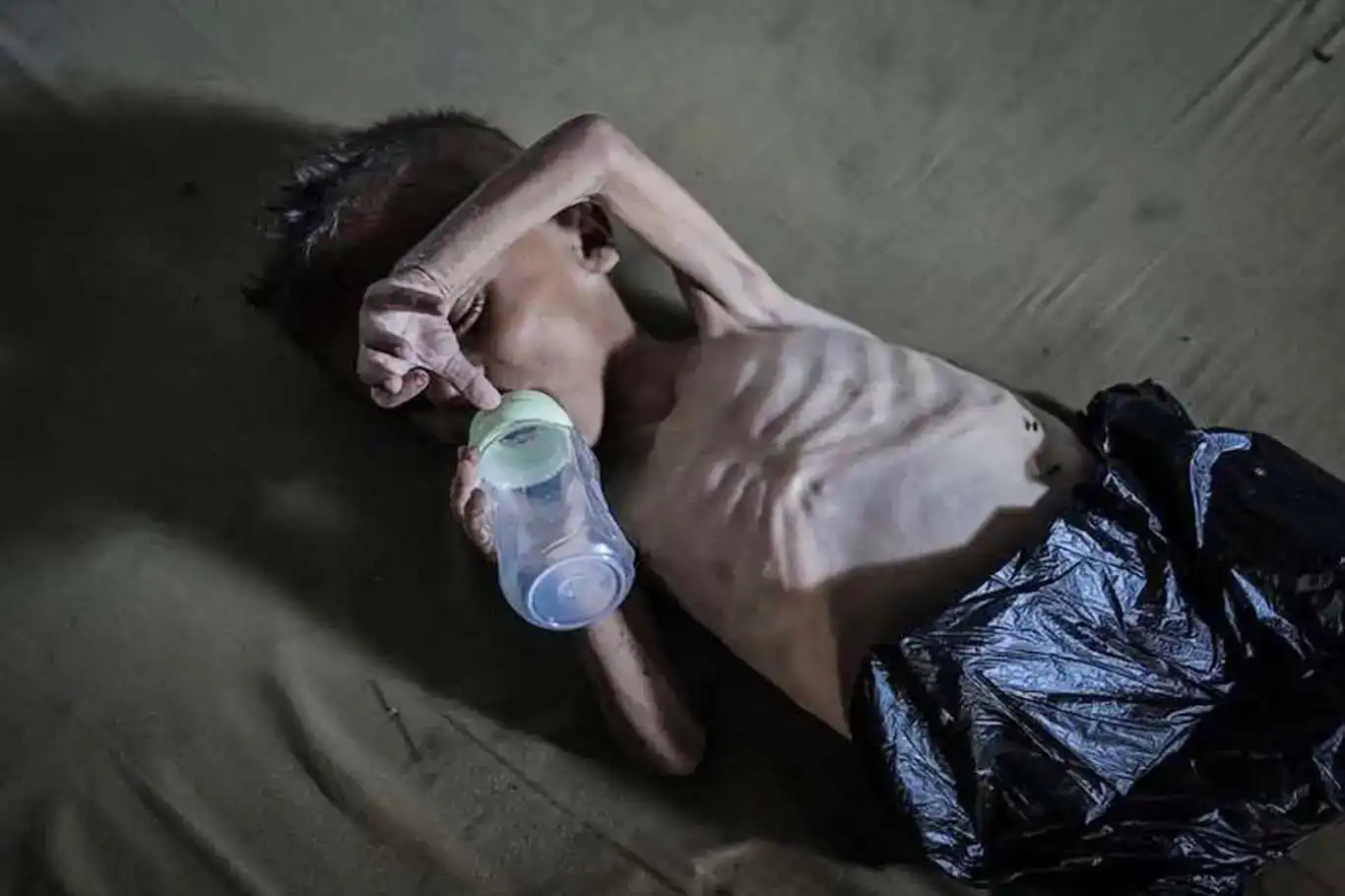 غزة تواجه خطر وفاة جماعية إثر تفشي متلازمة "غيلان باريه" وسط انهيار صحي شامل غزة تواجه خطر وفاة جماعية إثر تفشي متلازمة "غيلان باريه" وسط انهيار صحي شامل