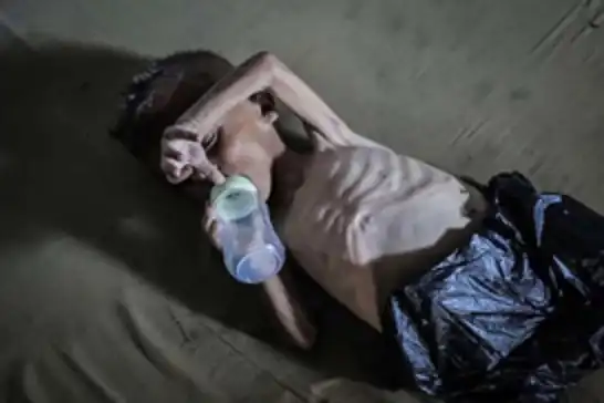 غزة تواجه خطر وفاة جماعية إثر تفشي متلازمة "غيلان باريه" وسط انهيار صحي شامل