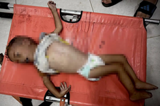 Five more Palestinians die of starvation in Gaza as blockade deepens humanitarian crisis