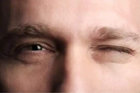 Göz seğirmesi masum mu hastalık habercisi mi?