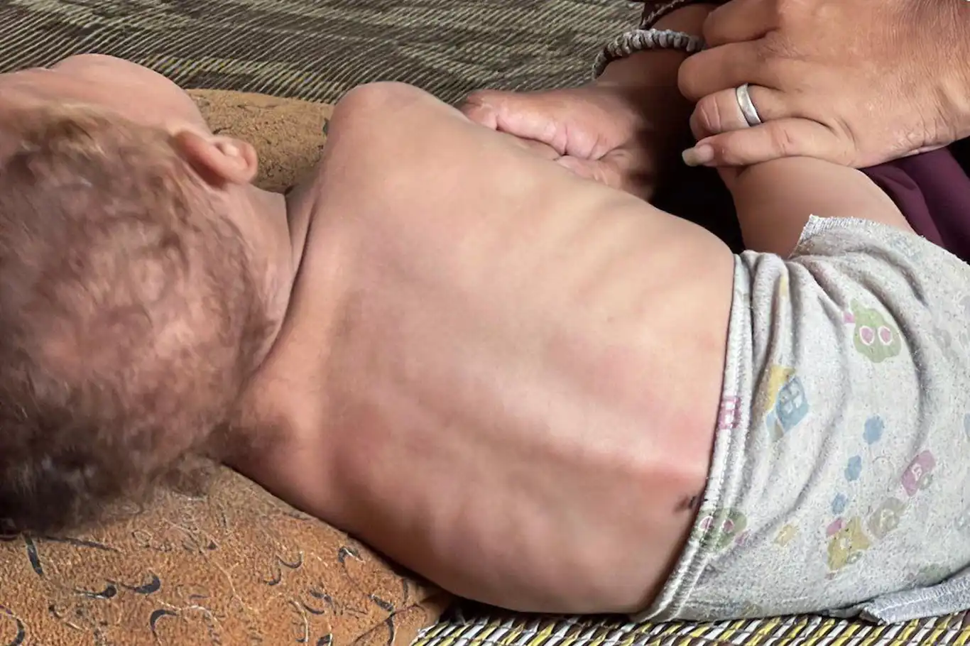 Son 24 saatte Gazze’de açlıktan 11 kişi daha şehid oldu Son 24 saatte Gazze’de açlıktan 11 kişi daha şehid oldu