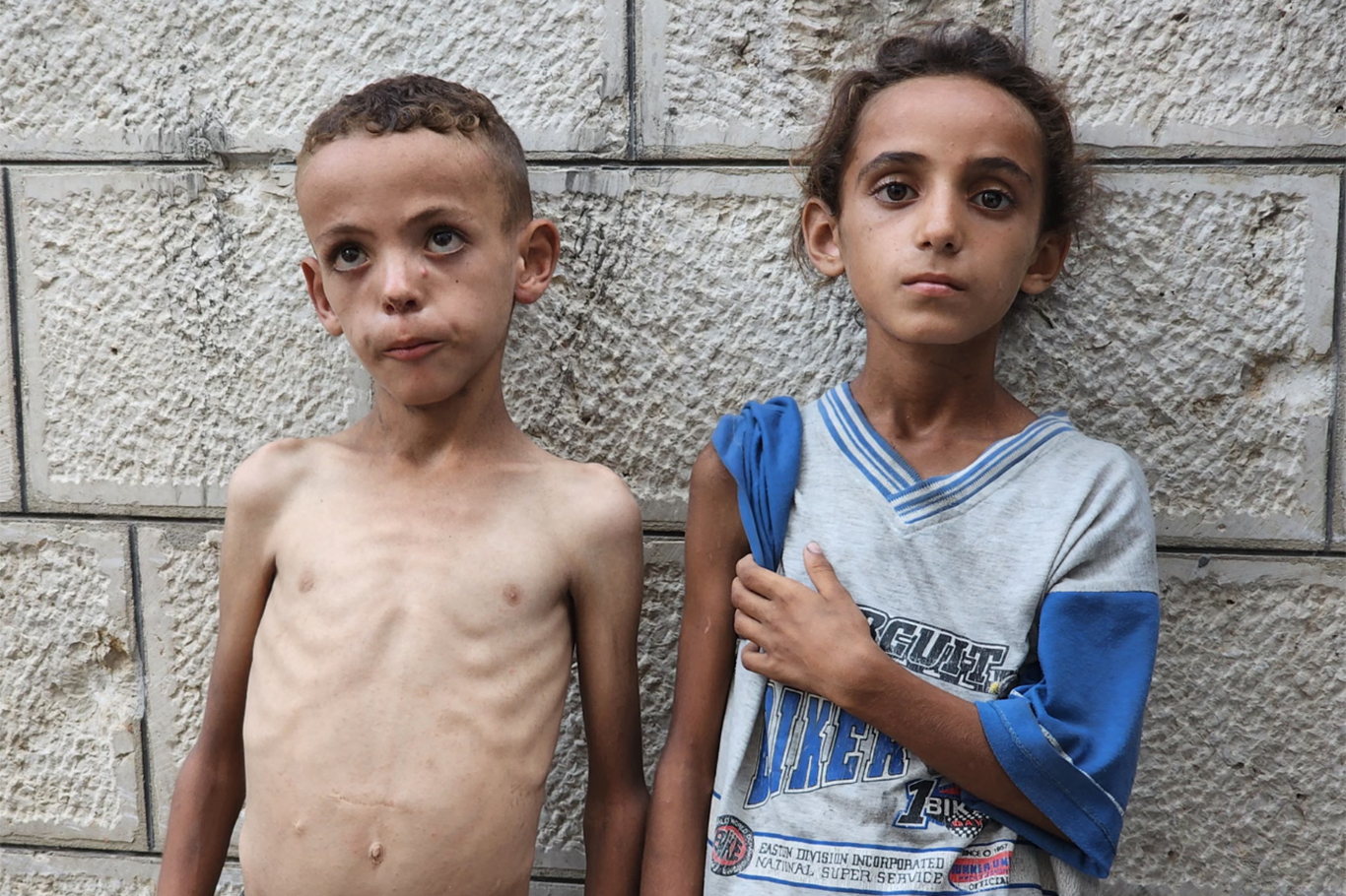 Five more Palestinians die of starvation as Gaza faces catastrophic famine Five more Palestinians die of starvation as Gaza faces catastrophic famine