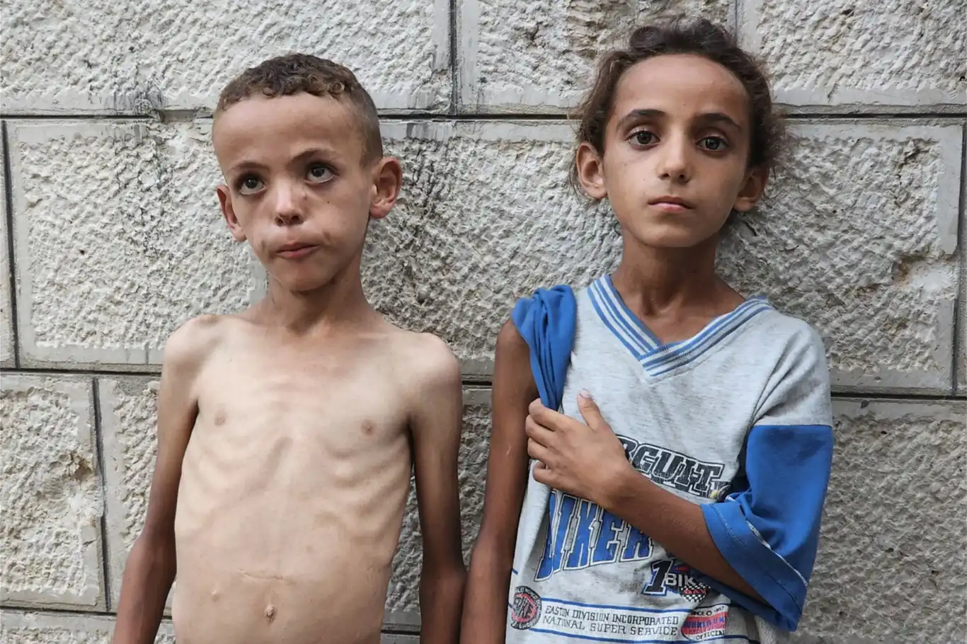 المأساة مستمرة في غزة..5 شهداء آخرين جراء التجويع وسوء التغذية المأساة مستمرة في غزة..5 شهداء آخرين جراء التجويع وسوء التغذية