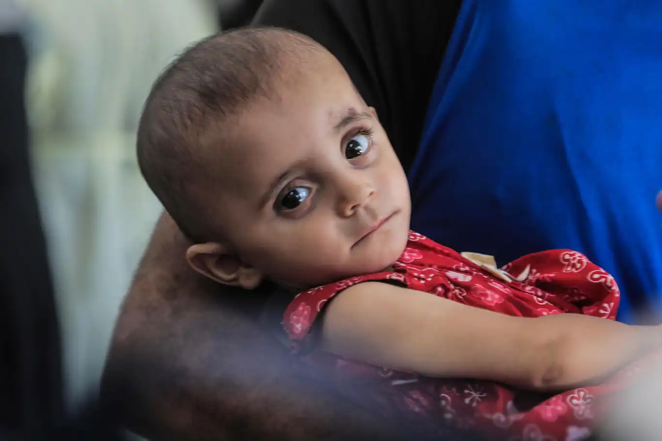 UNICEF sounds alarm on soaring child malnutrition in Gaza amid ongoing Israeli genocide UNICEF sounds alarm on soaring child malnutrition in Gaza amid ongoing Israeli genocide