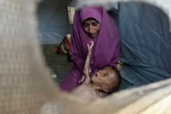Li Xezzeyê ji ber birçîbûnê di zarokan de weqayên kêmxwarin û mirinê zêde dibin
