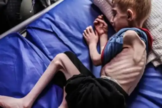 خلال الـ24 ساعة الماضية..استشهاد 13 فلسطينيًا بينهم 3 أطفال جراء التجويع الممنهج في غزة