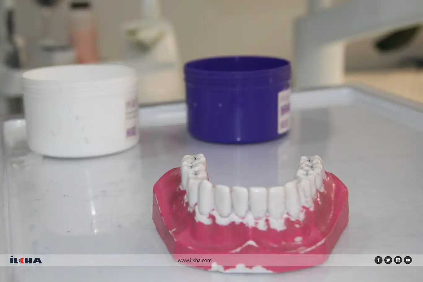 Diş beyazlatmada doğru bilinen yanlışlara dikkat