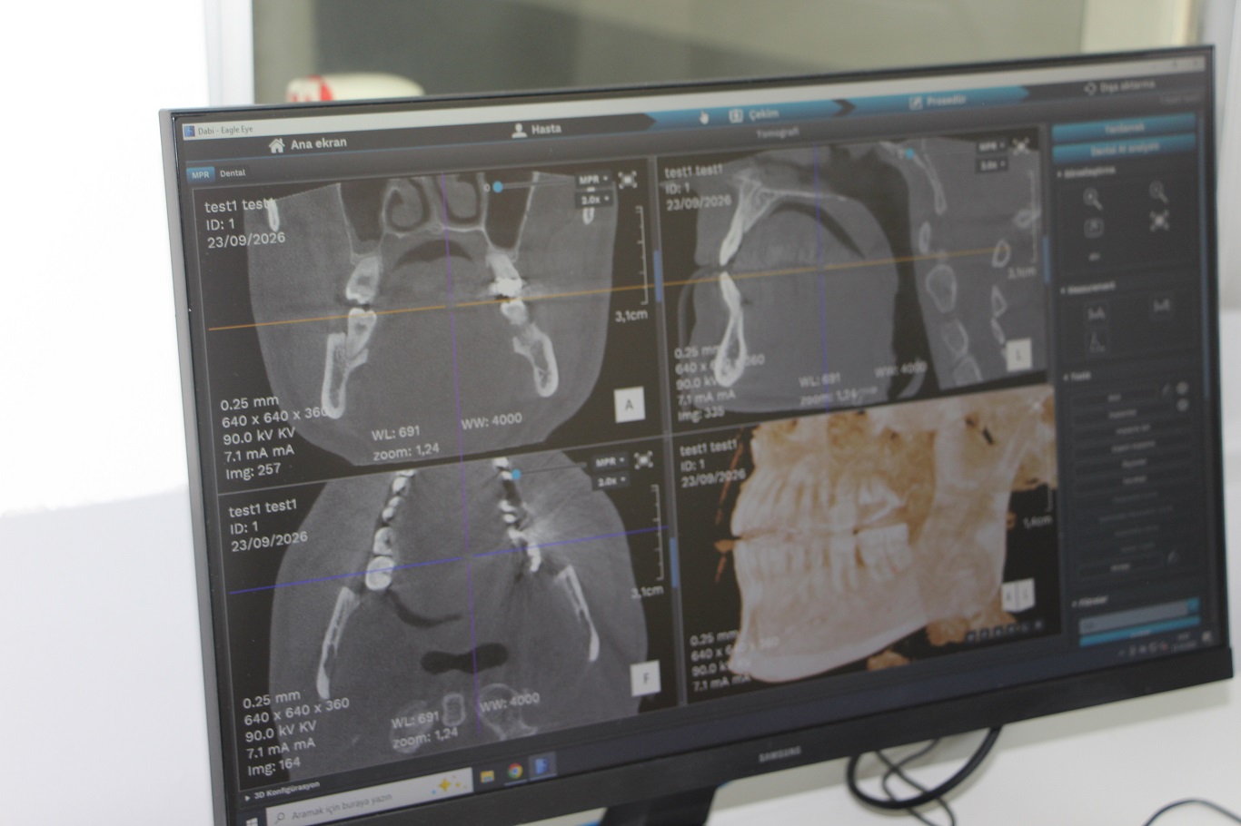 Mardin'de bir ilk: Üç boyutlu dental tomografi cihazı hizmete sunuldu