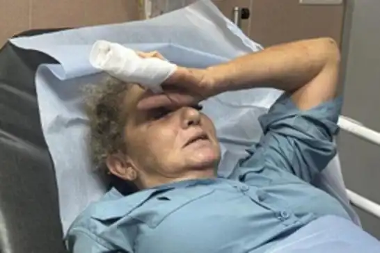 Israeli settlers brutally assault Washington Post photographer in West Bank