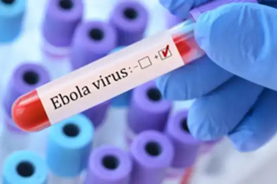 Fransa'da Ebola vakası tespit edildi