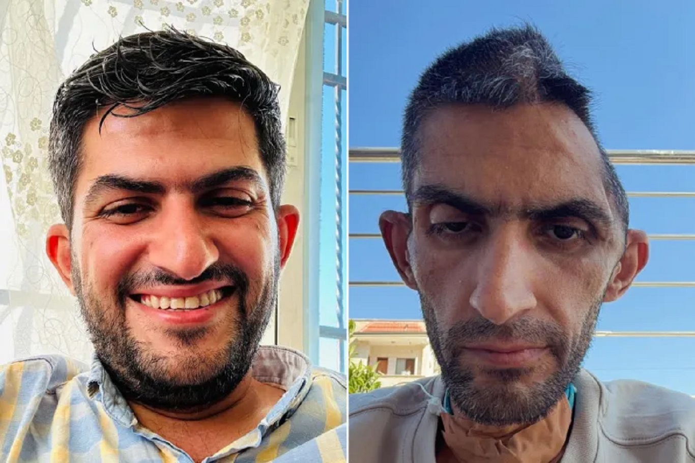 صورة صادمة لصحفي فلسطيني تكشف آثار التعذيب والمعاناة بعد 14 شهراً في سجون الاحتلال