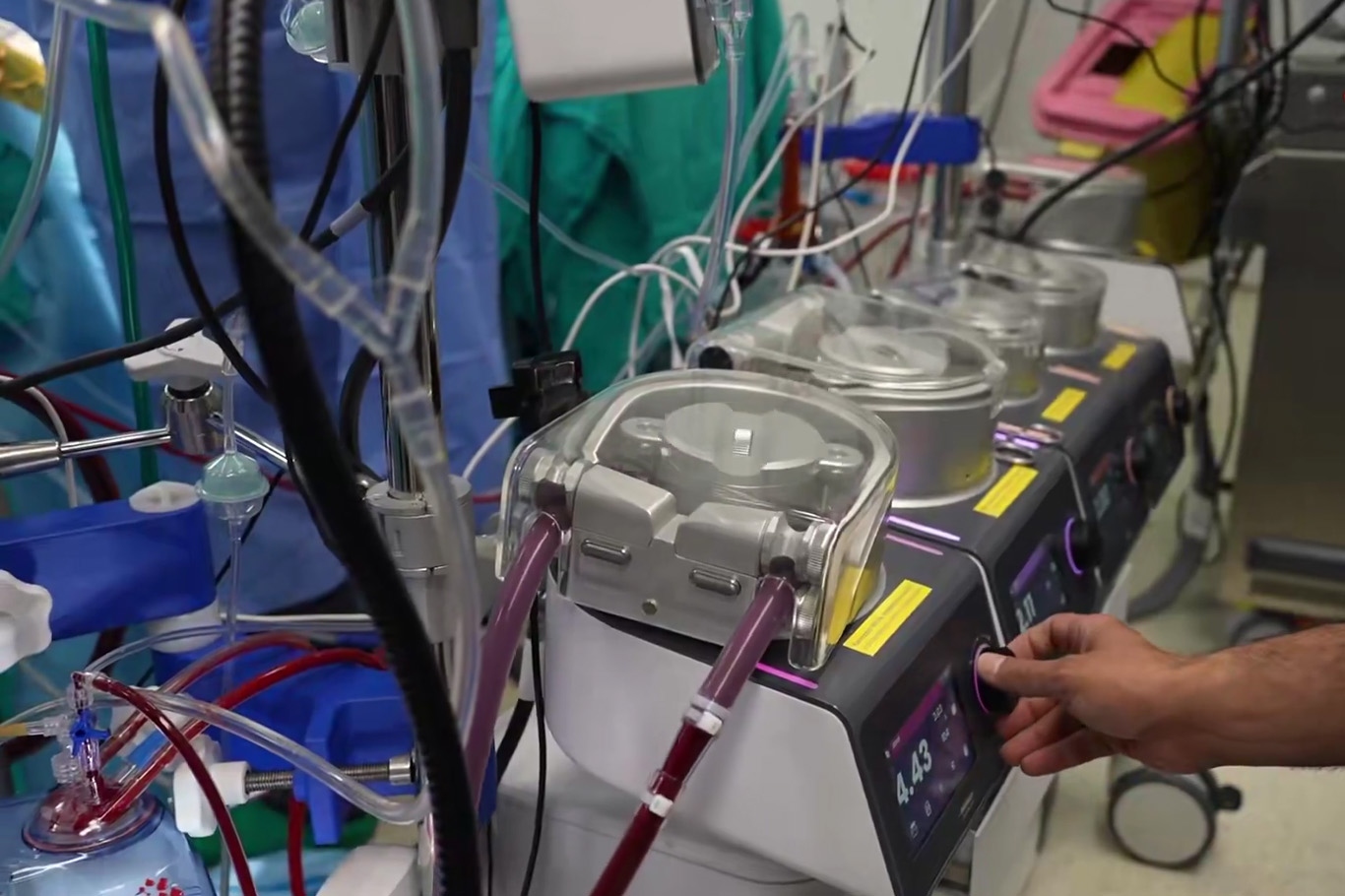 Türkiye successfully performs first surgery using domestically developed heart-lung machine