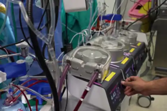 Türkiye successfully performs first surgery using domestically developed heart-lung machine