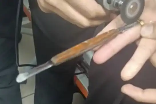 Batman'da parmağa sıkışan yüzük itfaiye ekiplerince kesildi