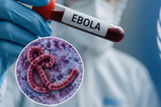 Kongo'da Ebola salgını: Ölü sayısı 1000'i aştı