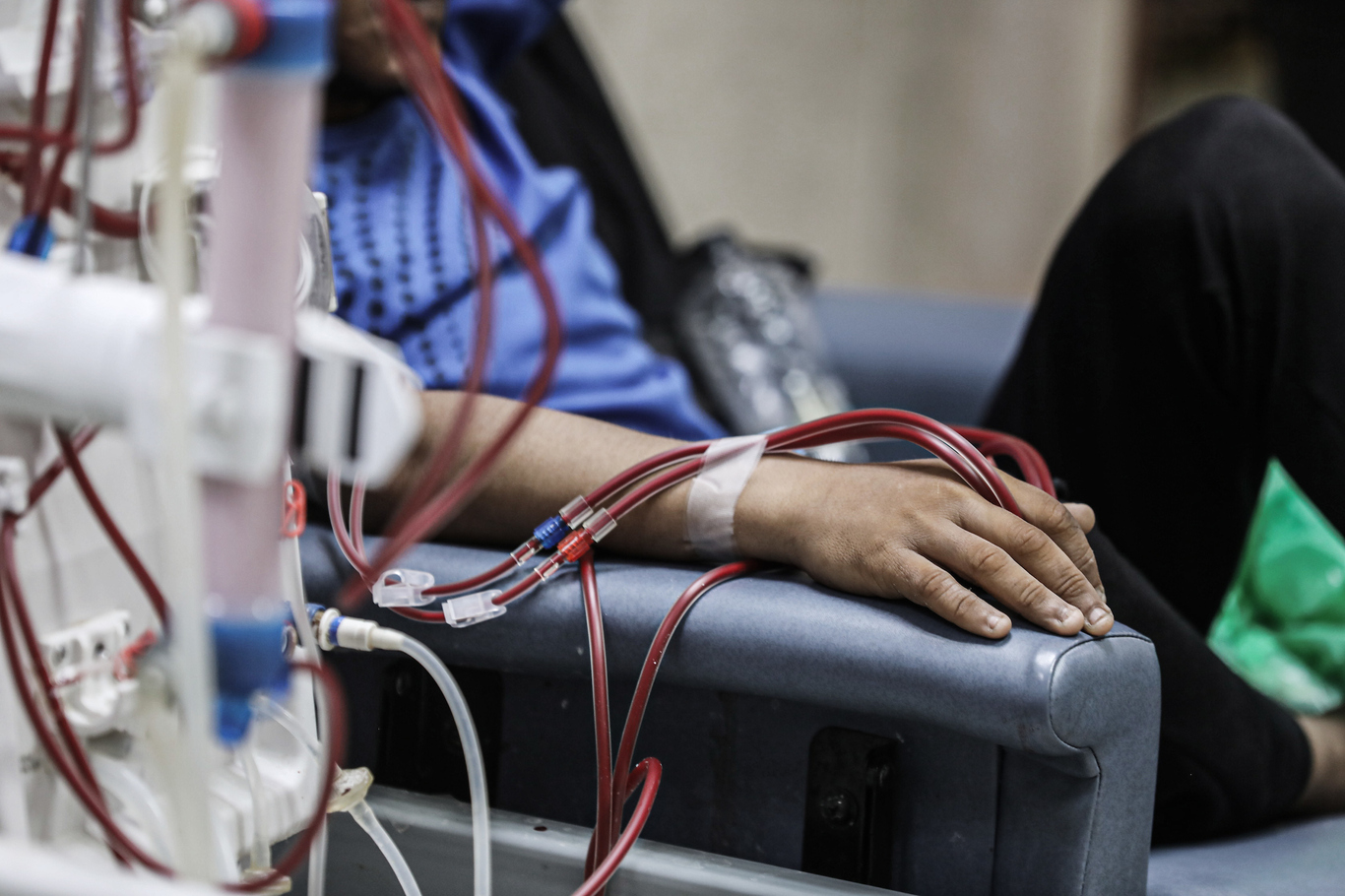 PCHR warns 650 kidney patients in Gaza face imminent risk of death