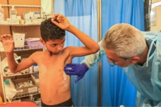 UN warns of sharp surge in chickenpox cases across Gaza amid worsening humanitarian crisis