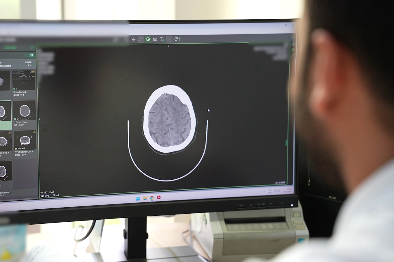 Alzheimer'a karşı uzmanından önemli uyarılar