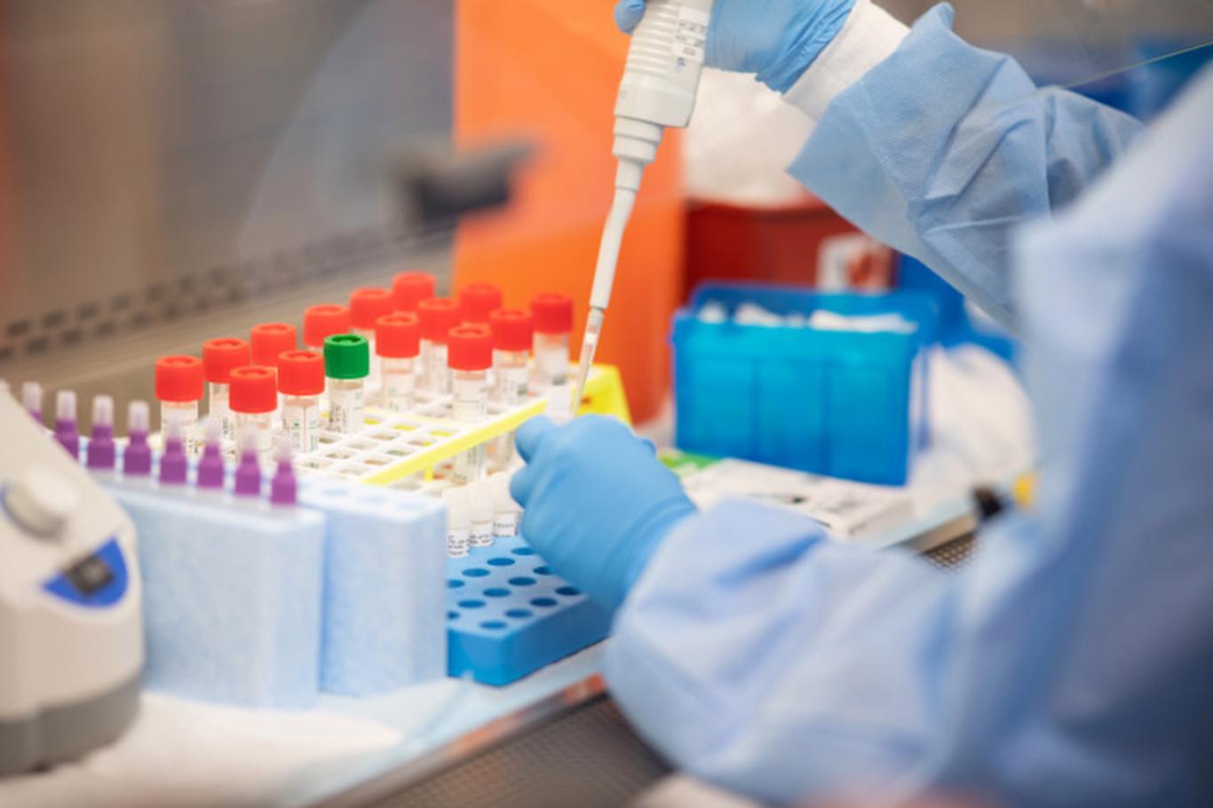 Coronavirus in Russia: The number of deaths surpasses 10,000