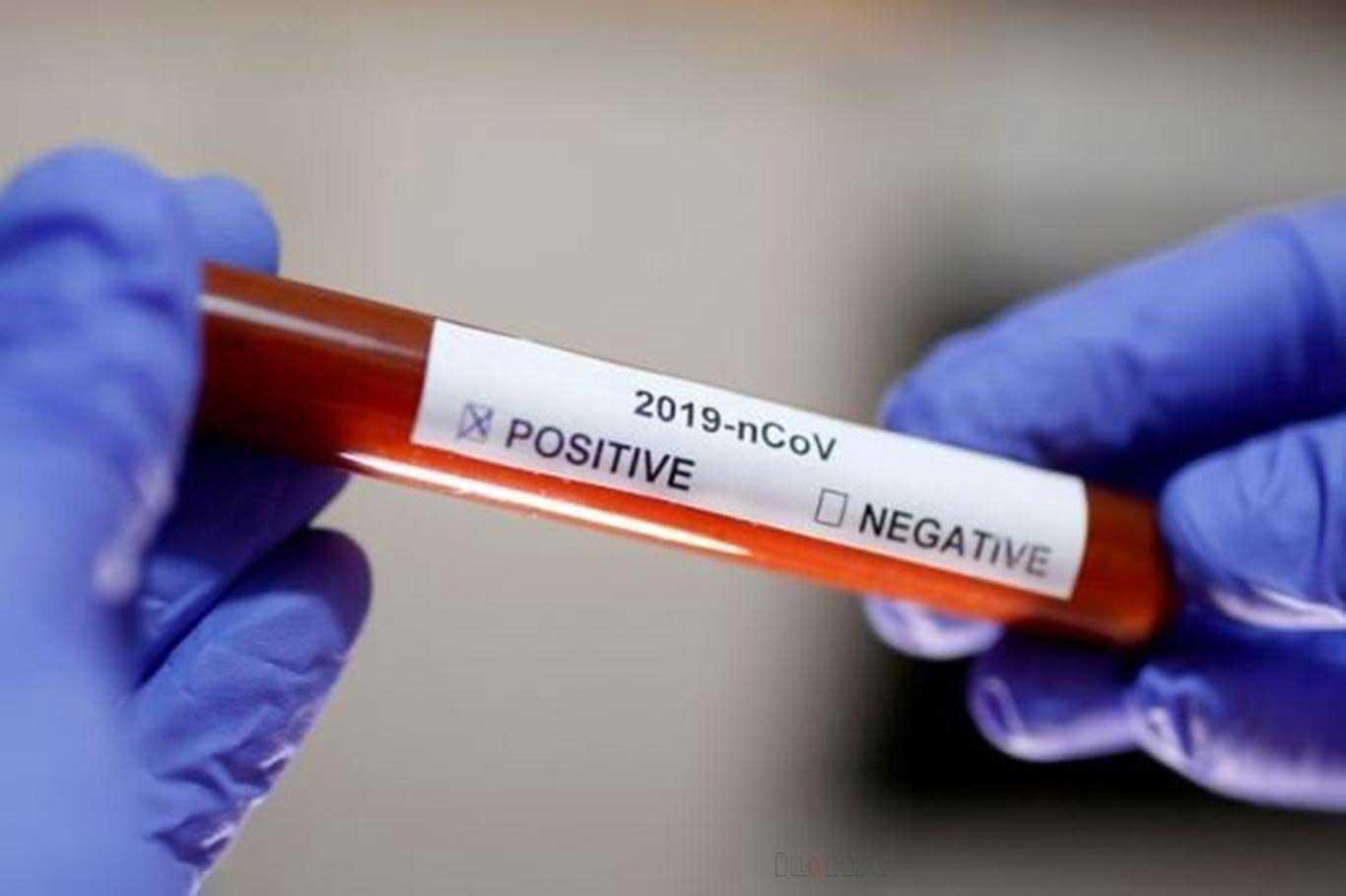 Coronavirus worldwide: The number of confirmed cases reaches 6,268,025