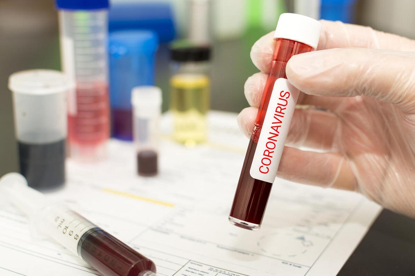 The number of deaths from coronavirus rises to 97,696 in the United States