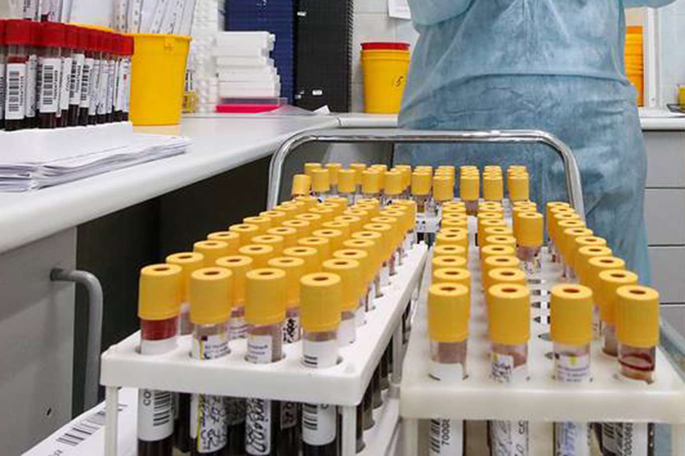 Turkey records 217 coronavirus deaths, 26,217 new cases within 24 hours