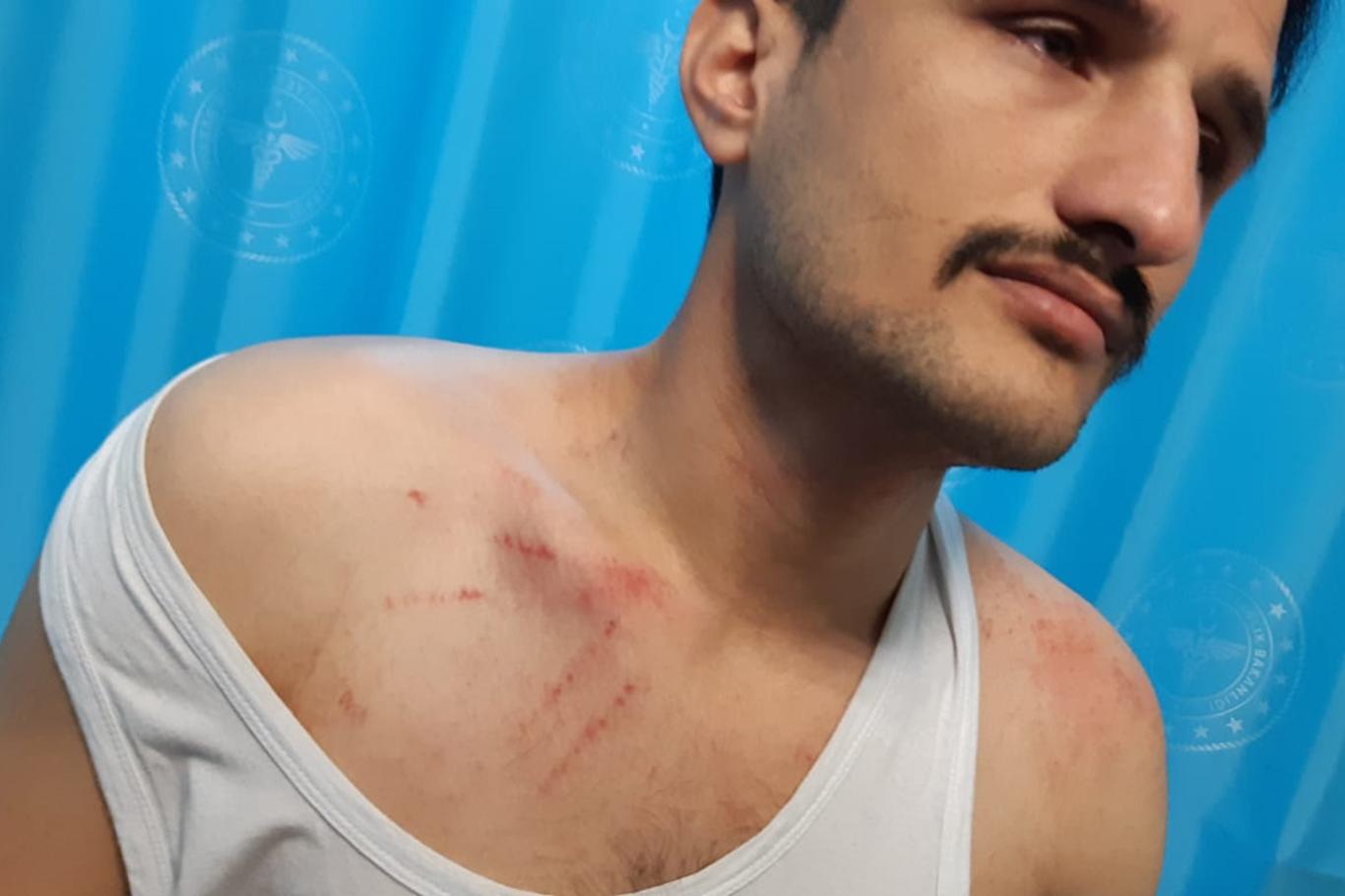 Güvenlik korucuları başkanına saldırı