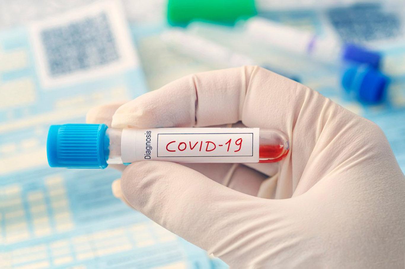 İran'da Covid-19 kaynaklı ölü sayısı 17 bin 617'ye yükseldi 