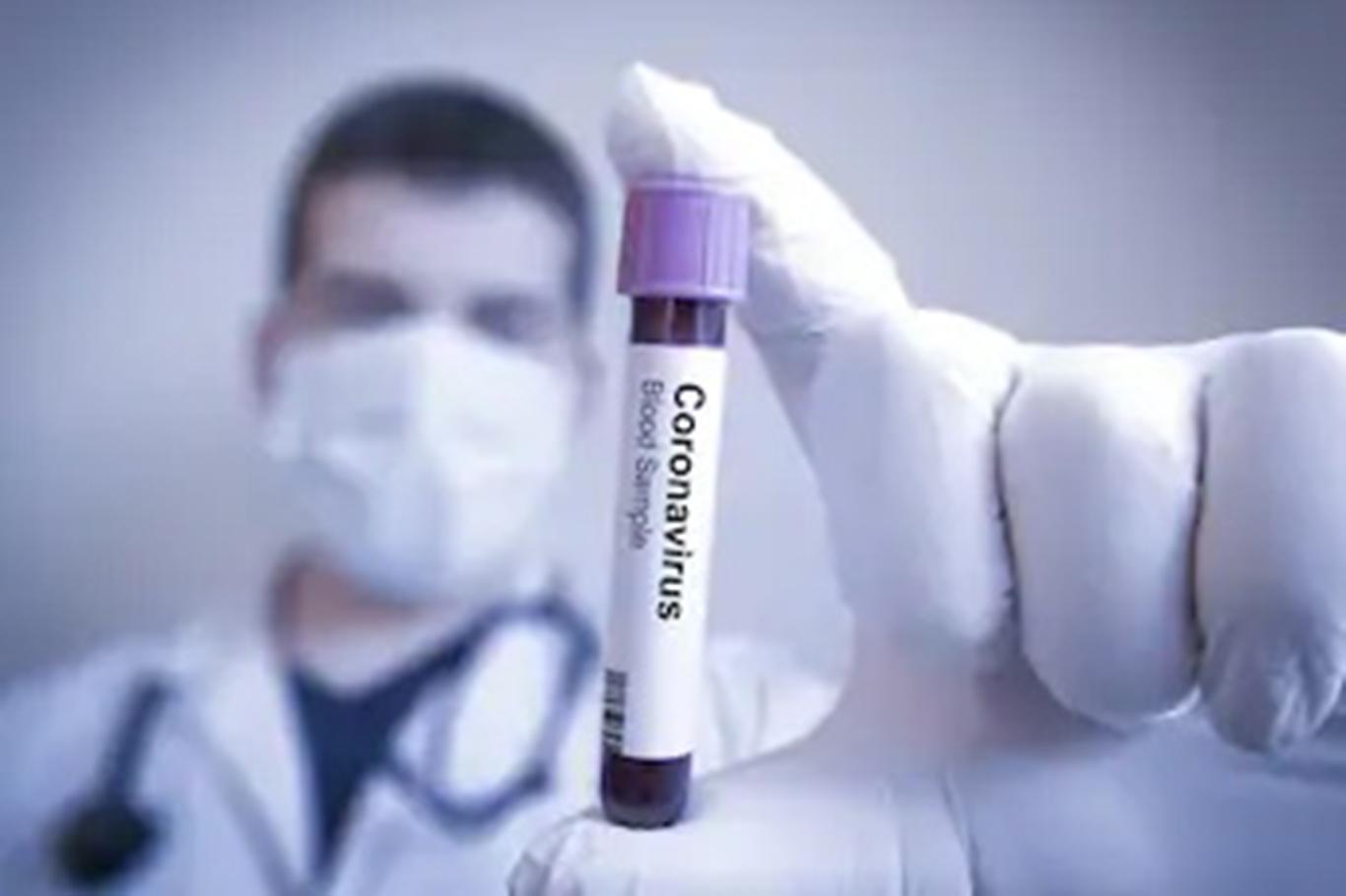 İstanbul'da 24 aile hekimi ve hemşirenin Coronavirus testi pozitif çıktı