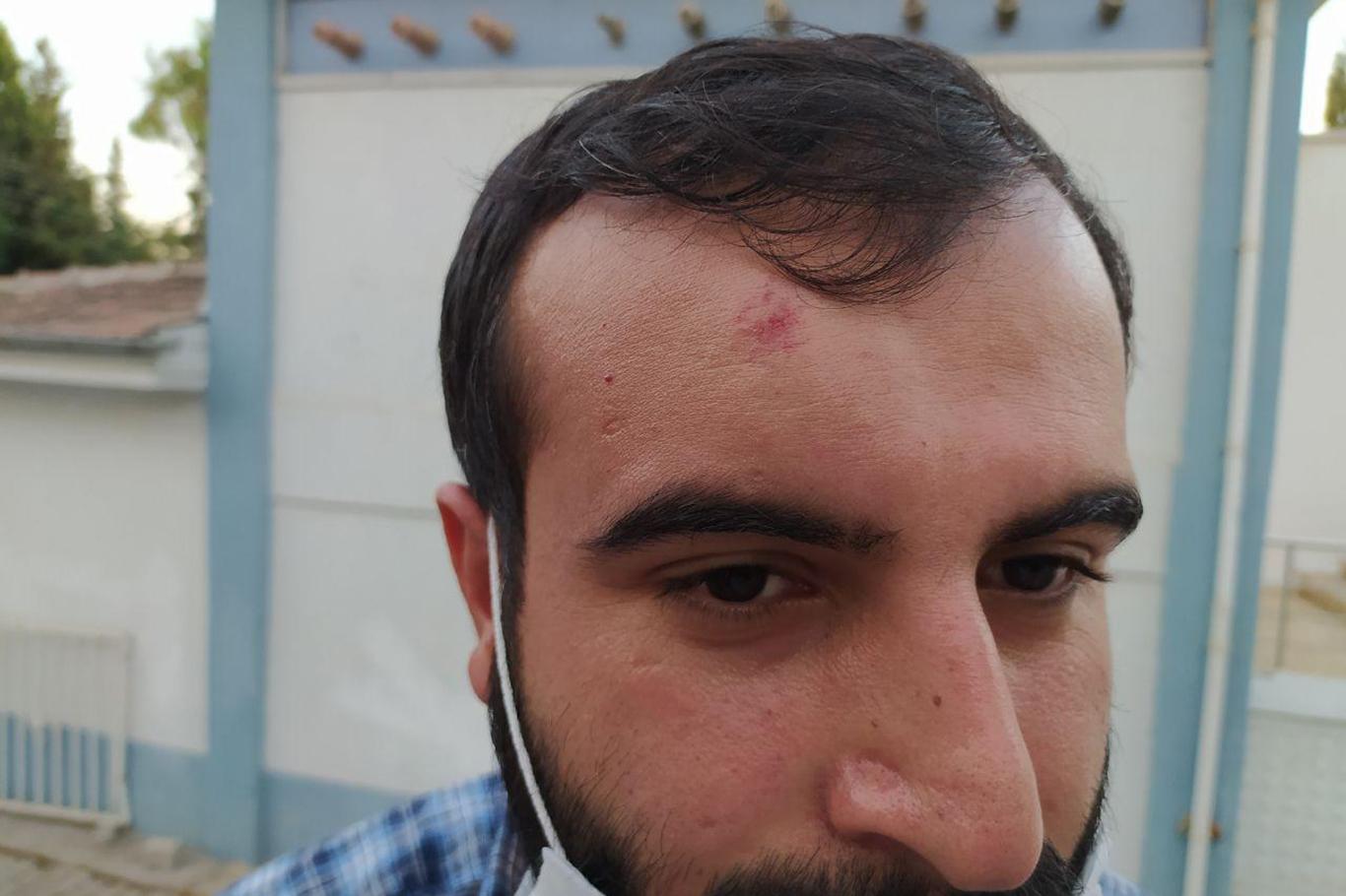 Şanlıurfa'da bir öğretmen darp edildi