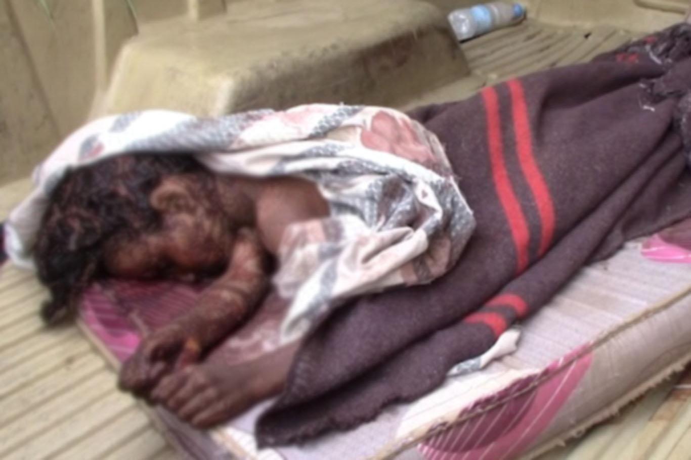 Suudi koalisyondan Yemen'e saldırı: 7 ölü 2 yaralı